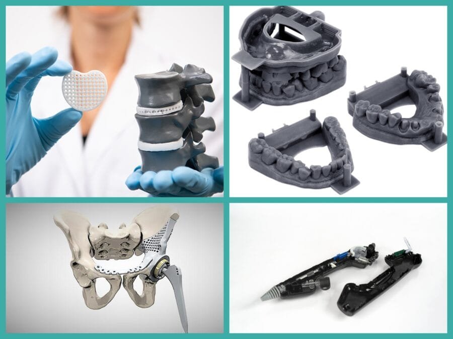 Medical 3D Printing Technology Services in Mumbai | Tesseract