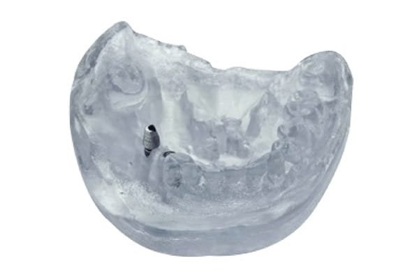 Bio-compatible-med 610 polyjet 3d printing color printing sla pritning sls printing metal 3d printing manufacturing prototyping services in mumbai 600