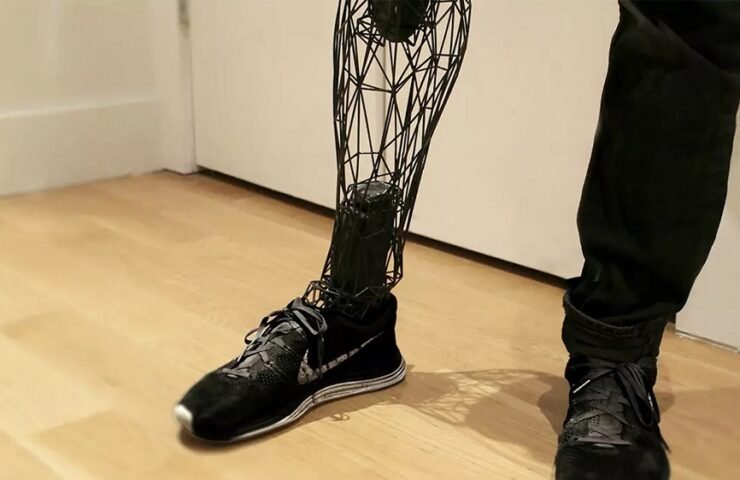 Why 3D Printing with Reverse Engineering Can Transform Prosthetics!