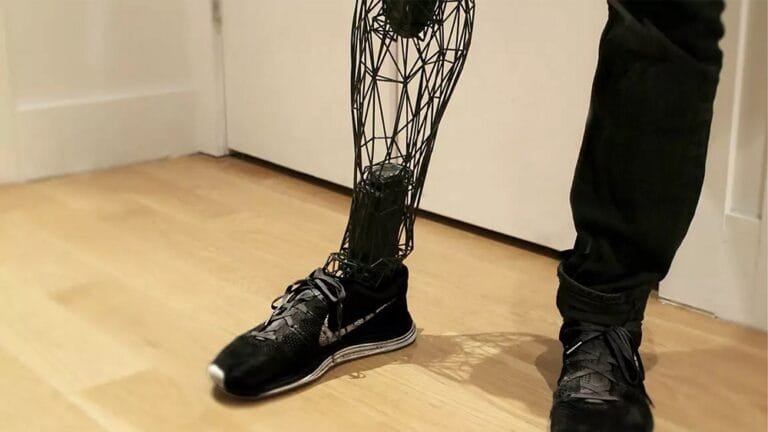 Why 3D Printing with Reverse Engineering Can Transform Prosthetics!